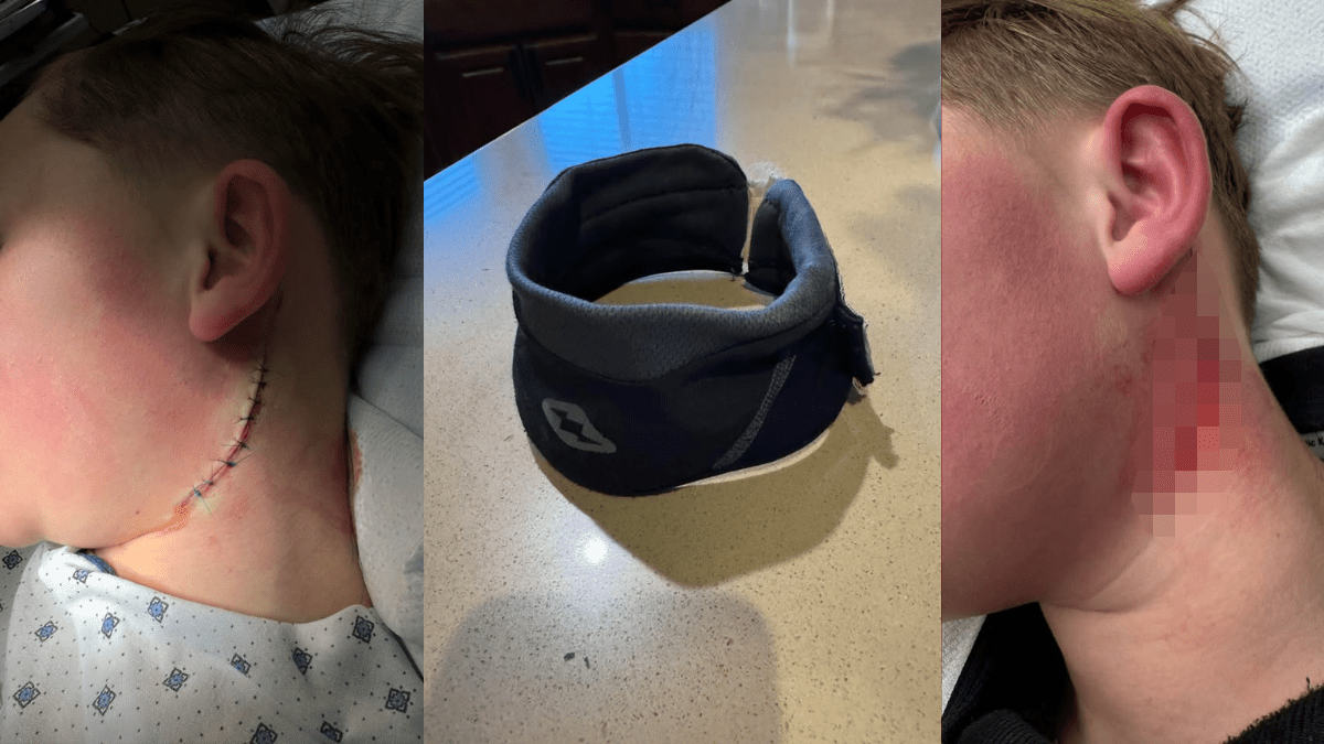 Neck guard saves Casper youth player's life in hockey accident