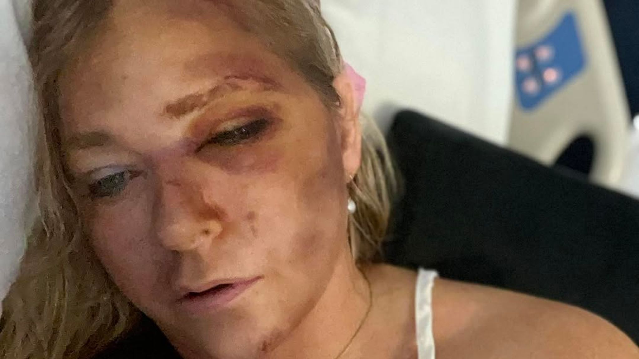 Virginia Giuffre, who accused Prince Andrew of sexual assault, says she has days to live after car crash