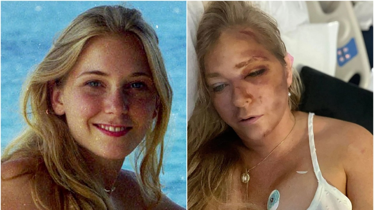 Accuser of Prince Andrew discloses severe injuries from car accident: Given 4 days to survive