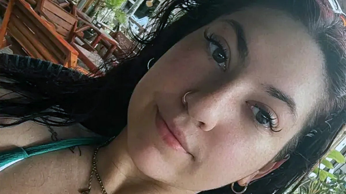 American nurse becomes 'all metal' after tragic accident on vacation overseas