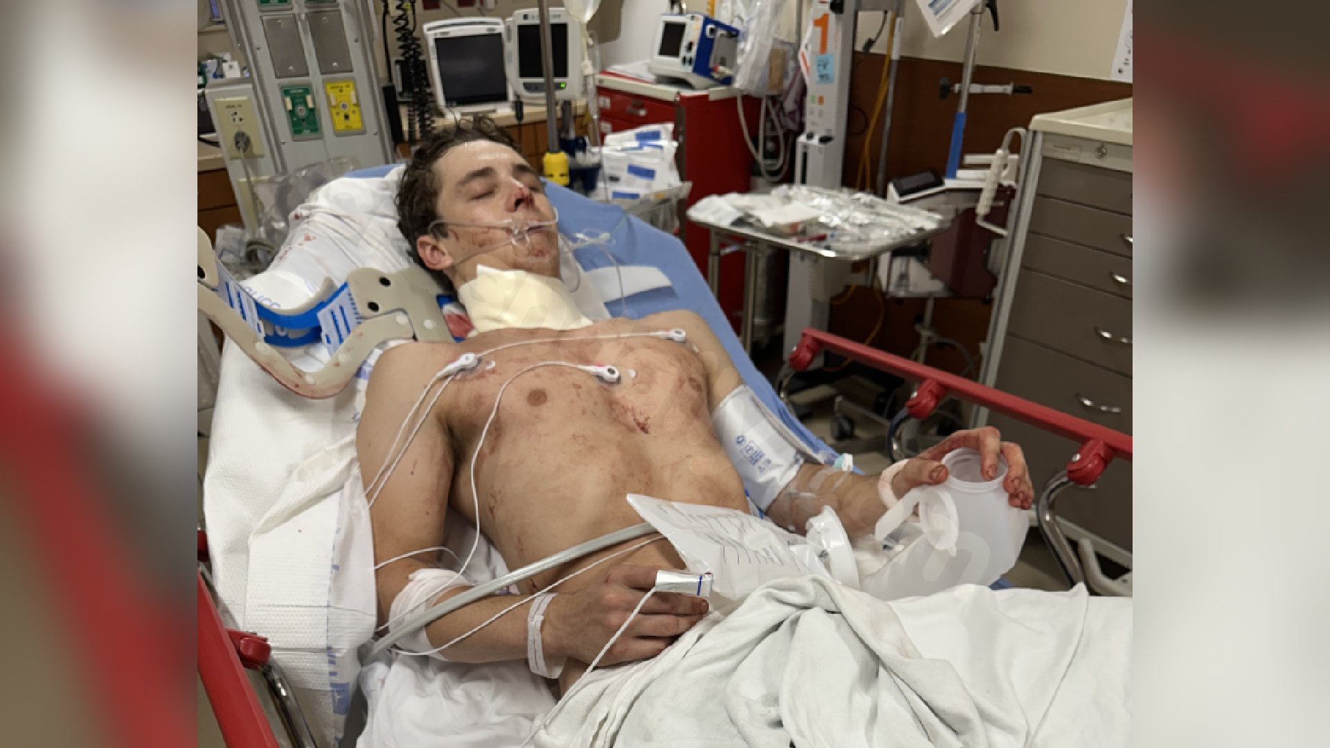 Louisiana bull rider survives serious accident and plans comeback.