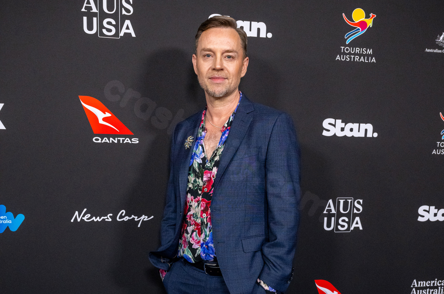 Savage Garden’s Darren Hayes Says ‘Terrible Accident’ Left His Jaw Broken : ‘I Could Have Died’