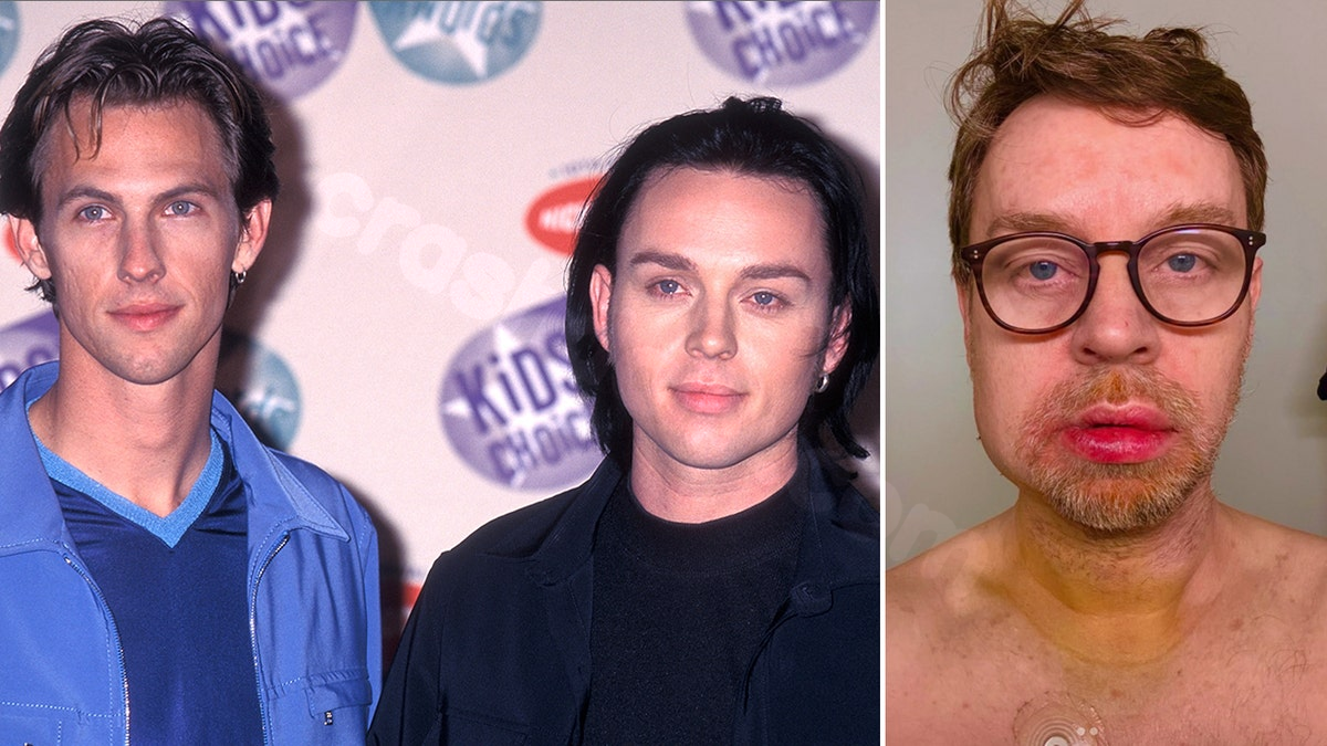 Savage Garden singer suffered ‘terrible accident’ two months after his mother passed away