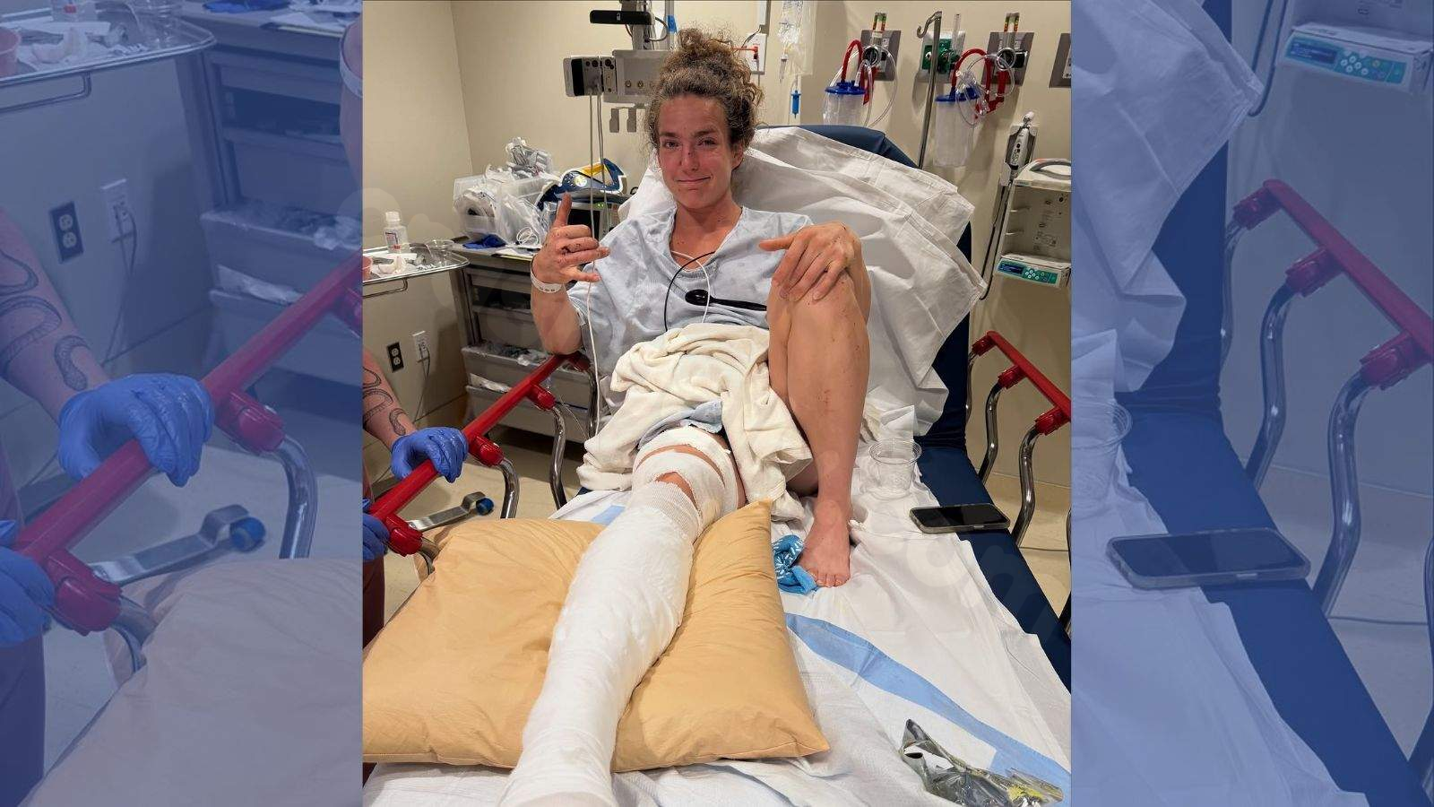 Alex Gazan's CrossFit Games Season at Risk Due to Car Crash Resulting in Fractured Fibula