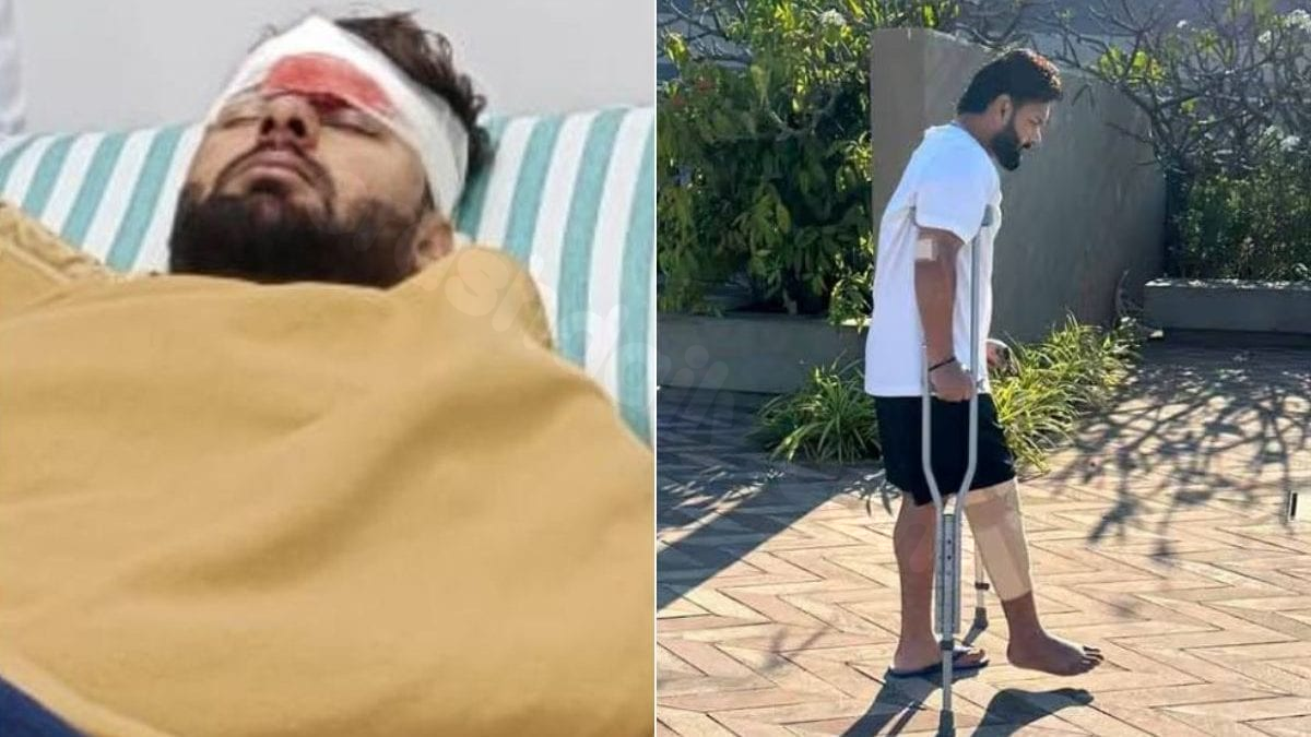Doctor tells Rishabh Pant after car accident: 'Limb loss risk'