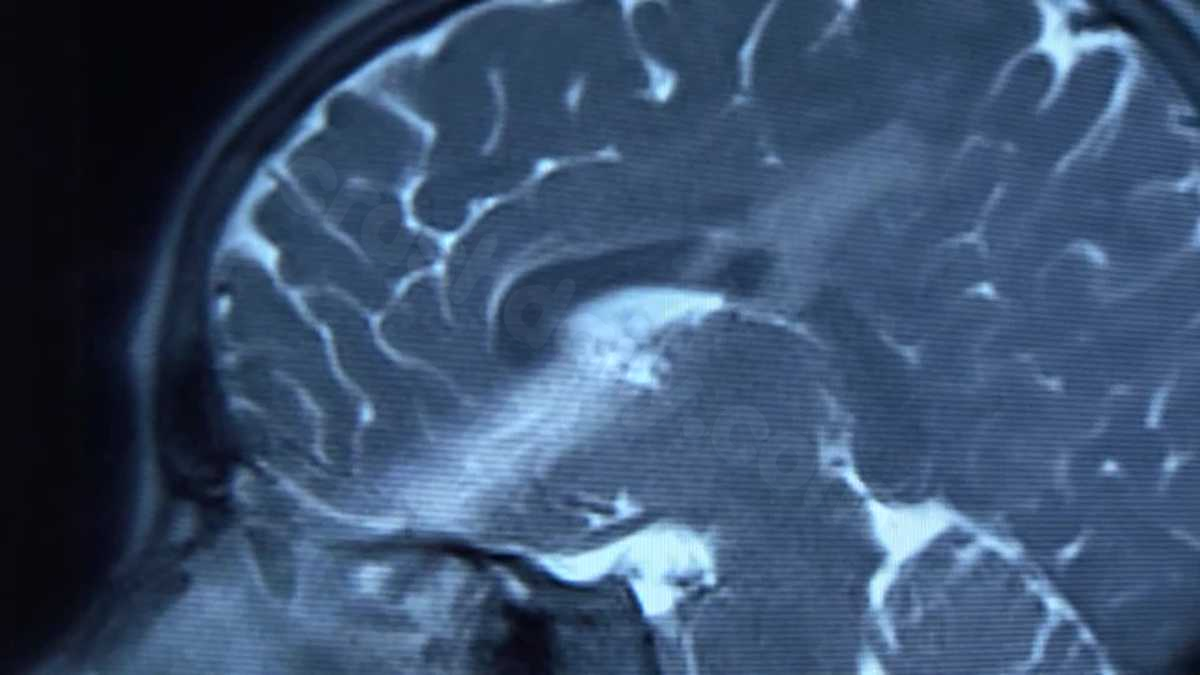 Boy, 9, survives after arrow goes through his brain in unexpected incident