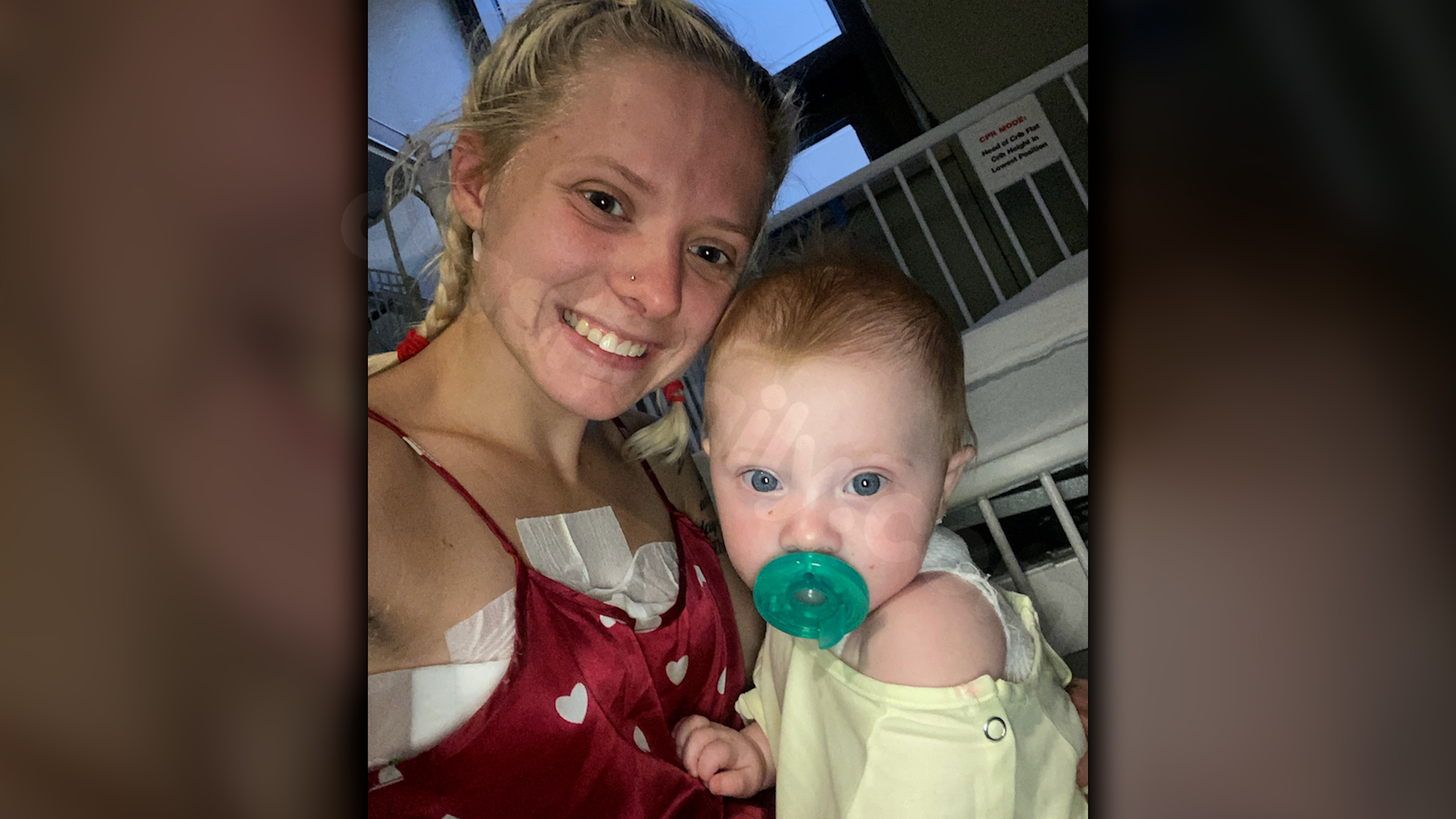 Clyde baby and mother healing after fireworks incident