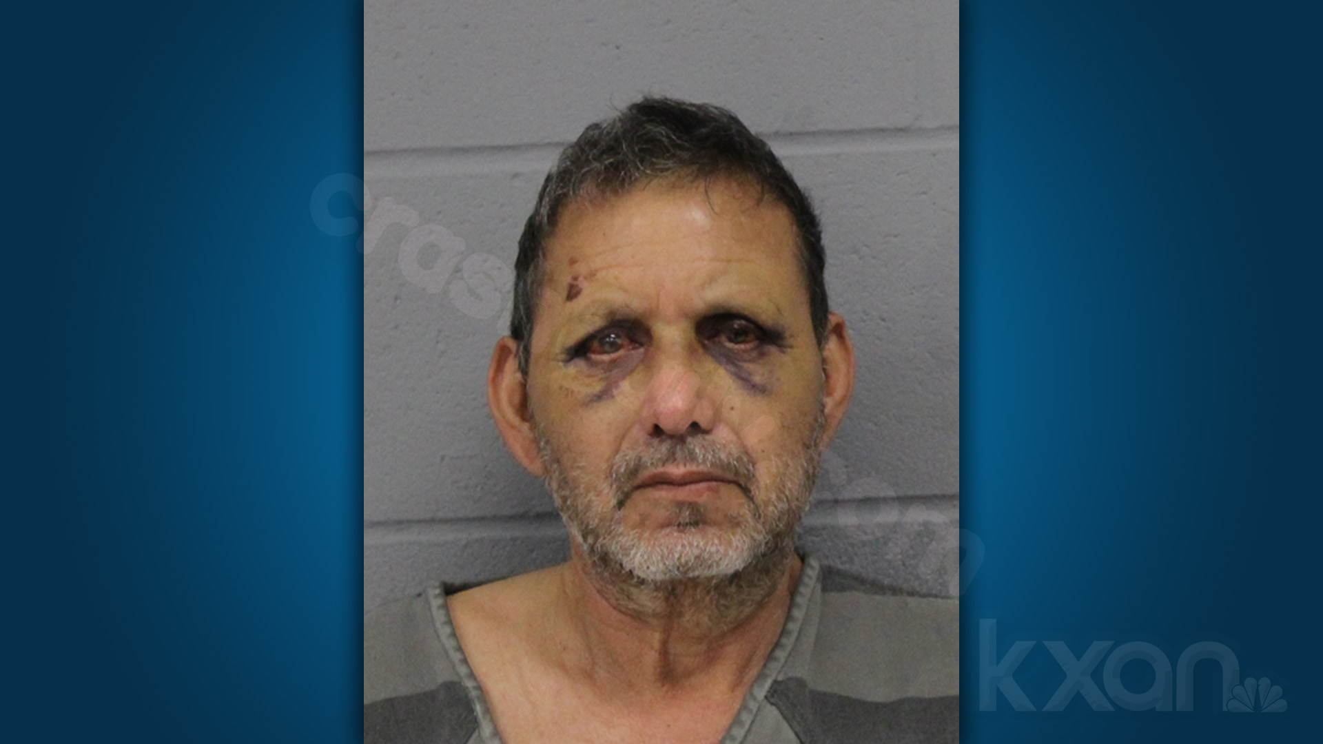 Migrant charged in fatal hit-and-run involving young girl