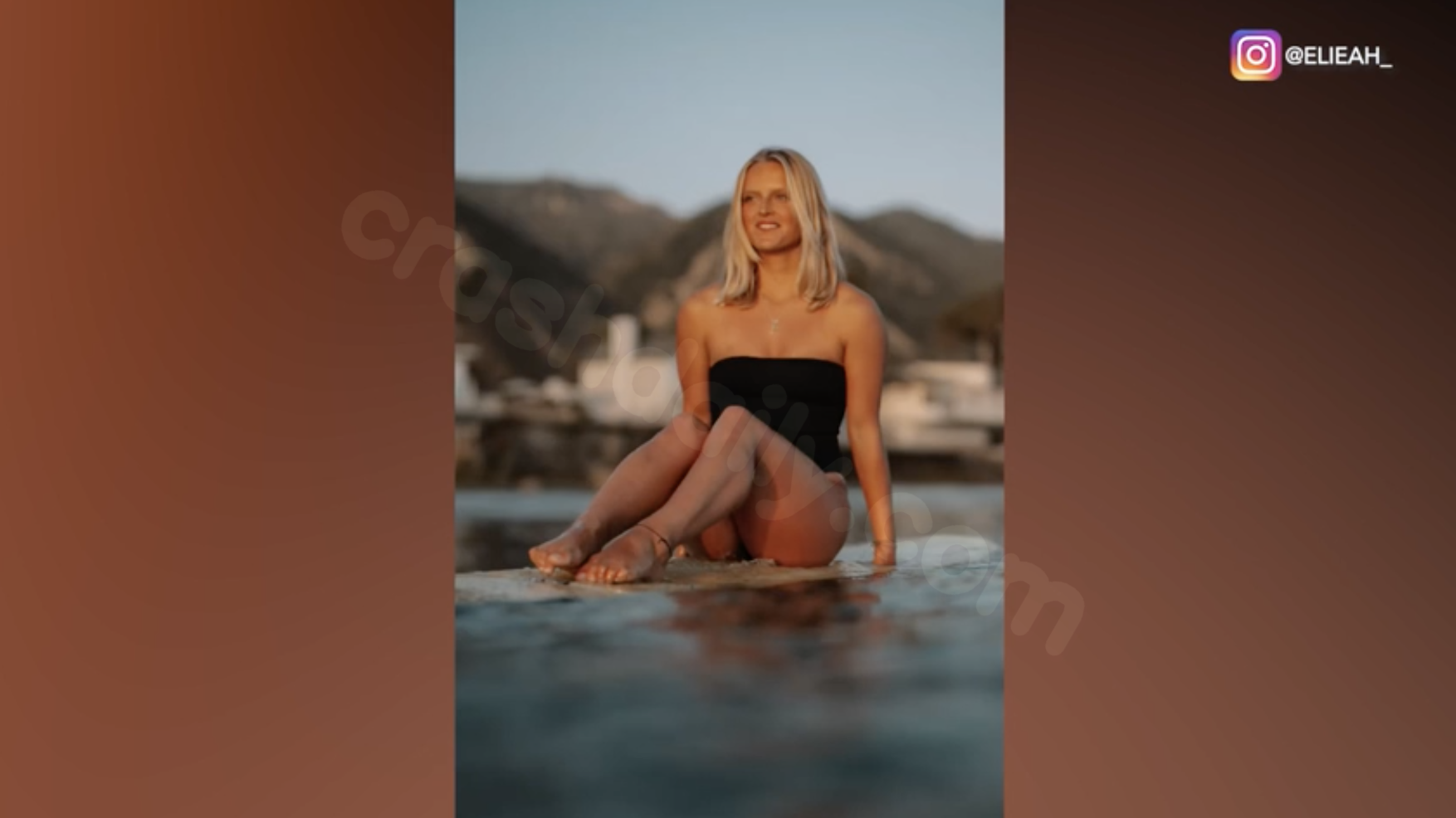 Injured California surf instructor, 24, recuperating after losing arm in tragic incident