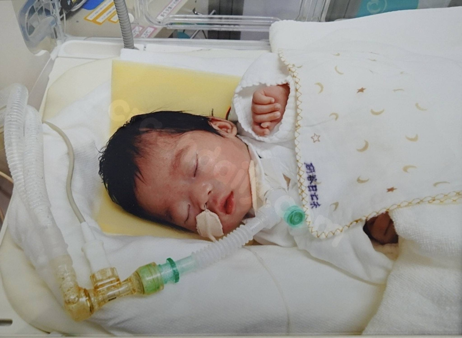 Family seeks recognition of daughter born after car crash.