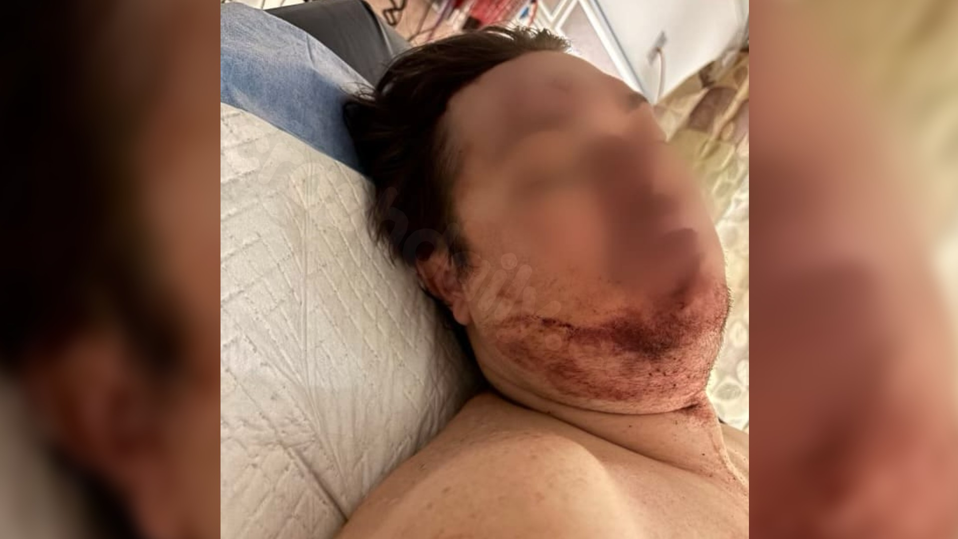 Man's head crushed by enraged mob following car accident