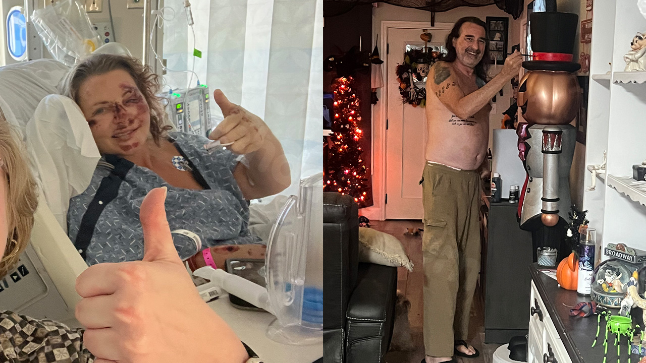 Couple injured in hit-and-run incident in Gulfport while riding e-scooter: 'Abandoned us injured'