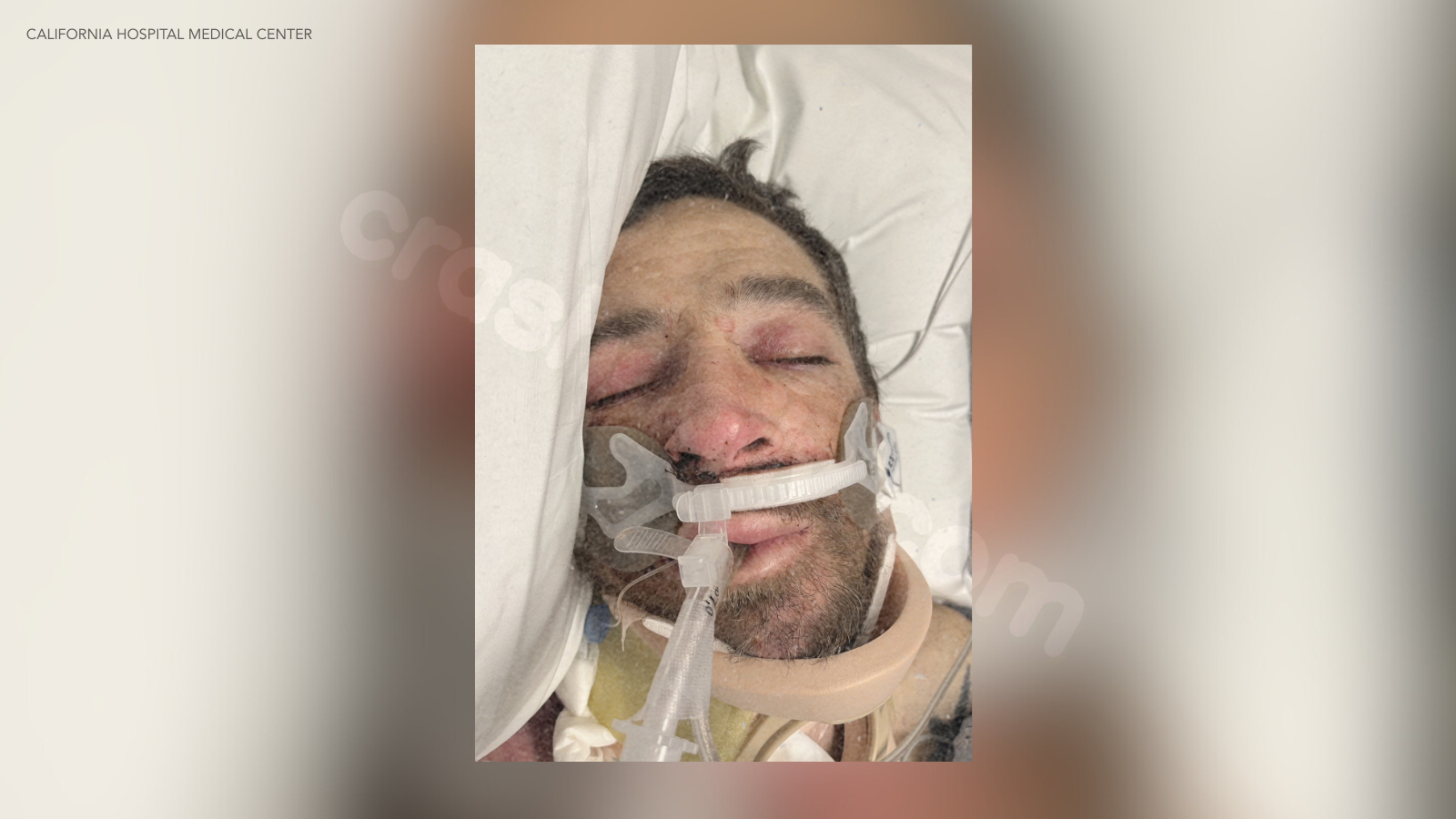 Hospital in Los Angeles seeks public assistance in identifying patient discovered following an accident