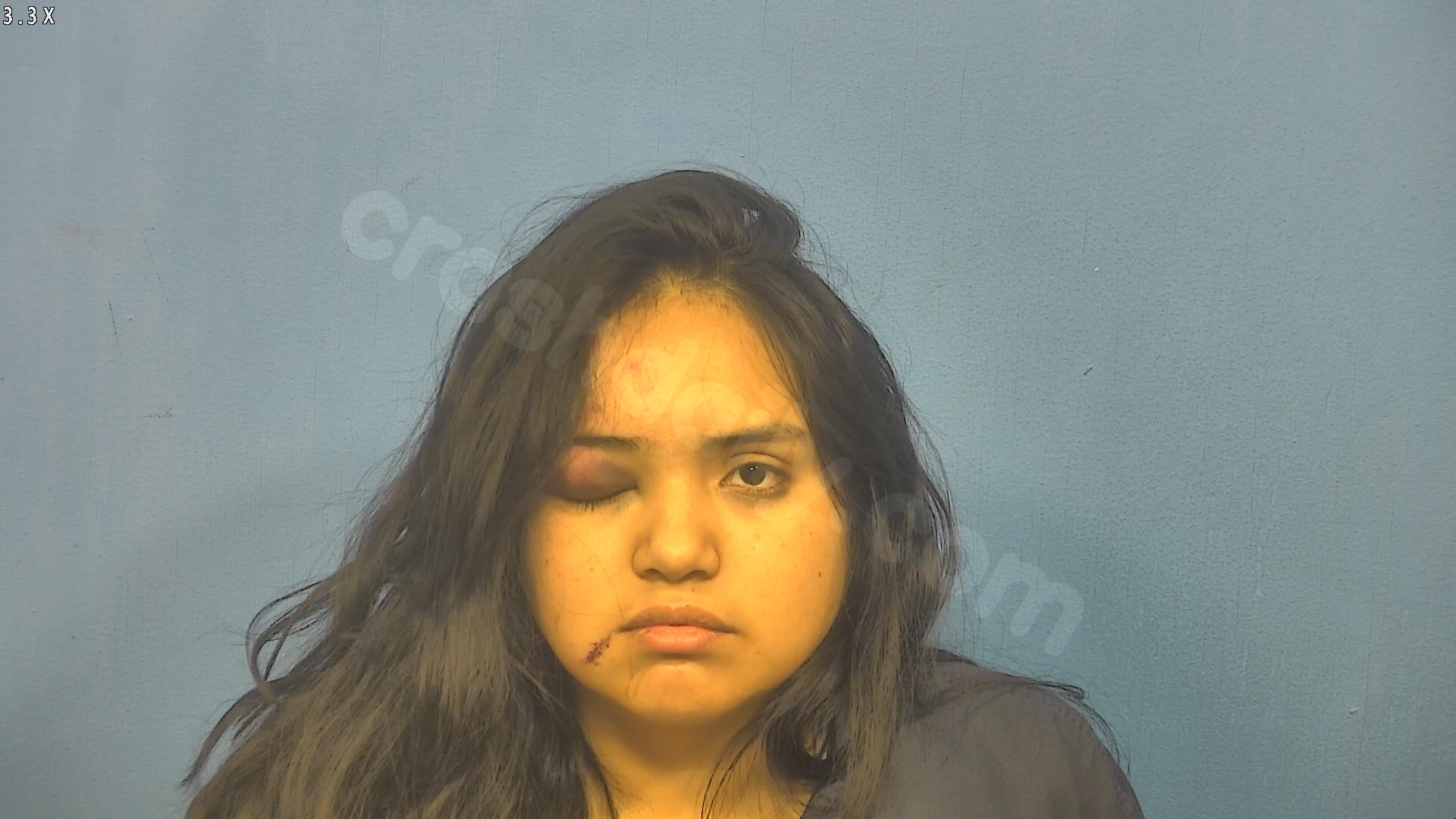 Chicago woman charged with DUI crash that caused severe injury to 10-year-old boy: prosecutors