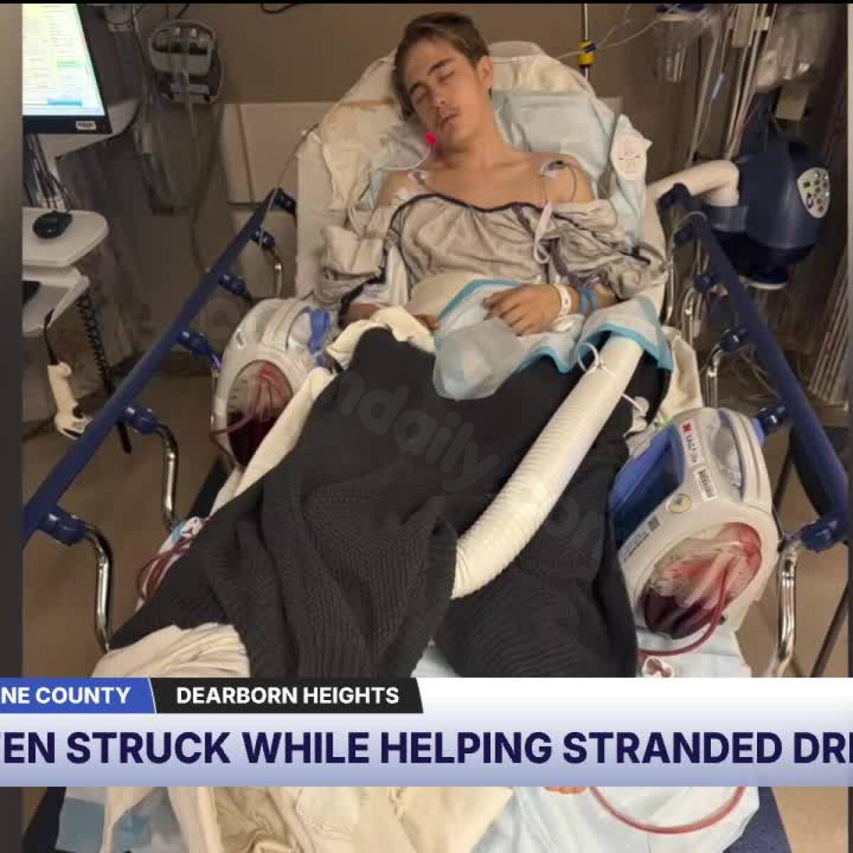 Teenage Good Samaritan injured in hospital after assisting stranded driver on Christmas Eve