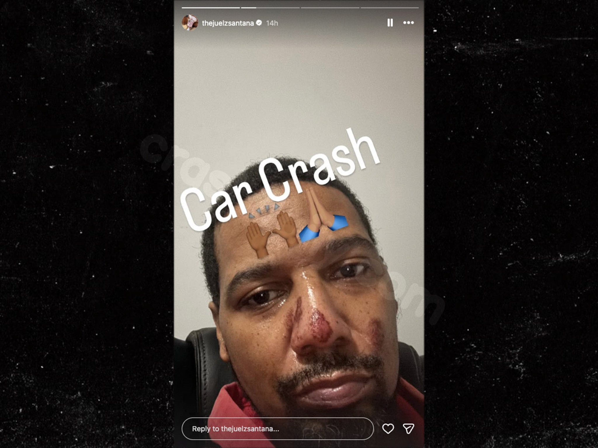 Juelz Santana Shares Selfie of Facial Scrapes Following Frightening Car Crash