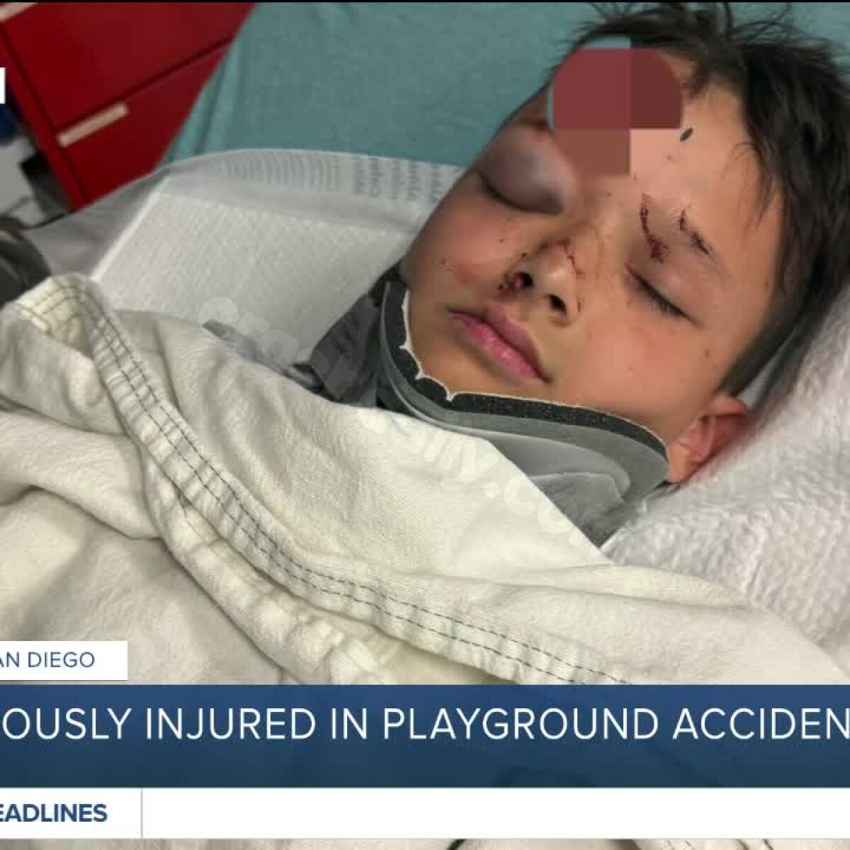 Child, 9, improving after severe playground mishap in La Mesa