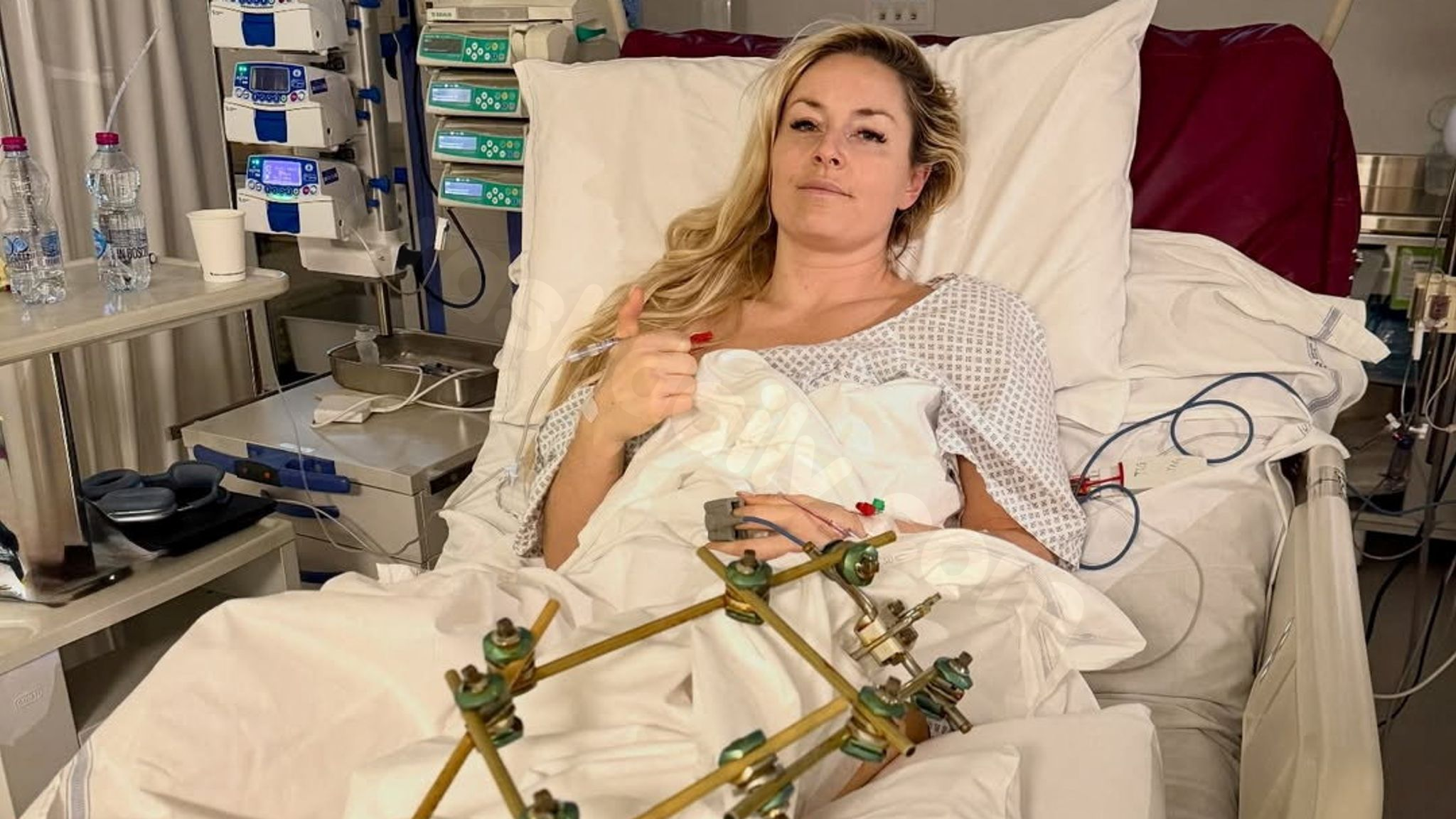Team USA skier Lindsey Vonn 'discharged from hospital' a week after horror Olympics crash