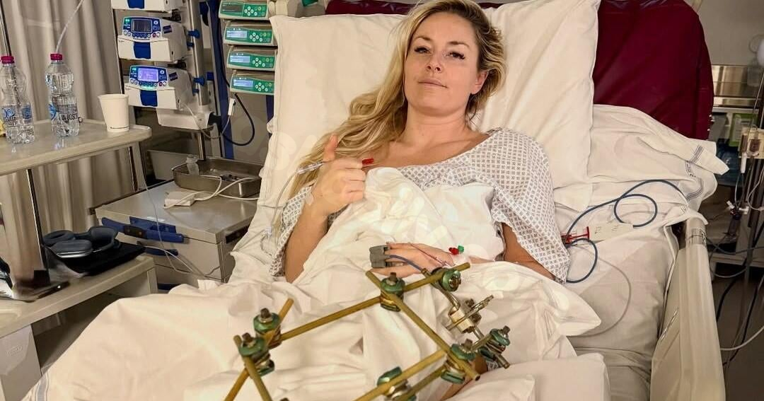 Lindsey Vonn says surgery saved her leg from amputation after Olympics crash