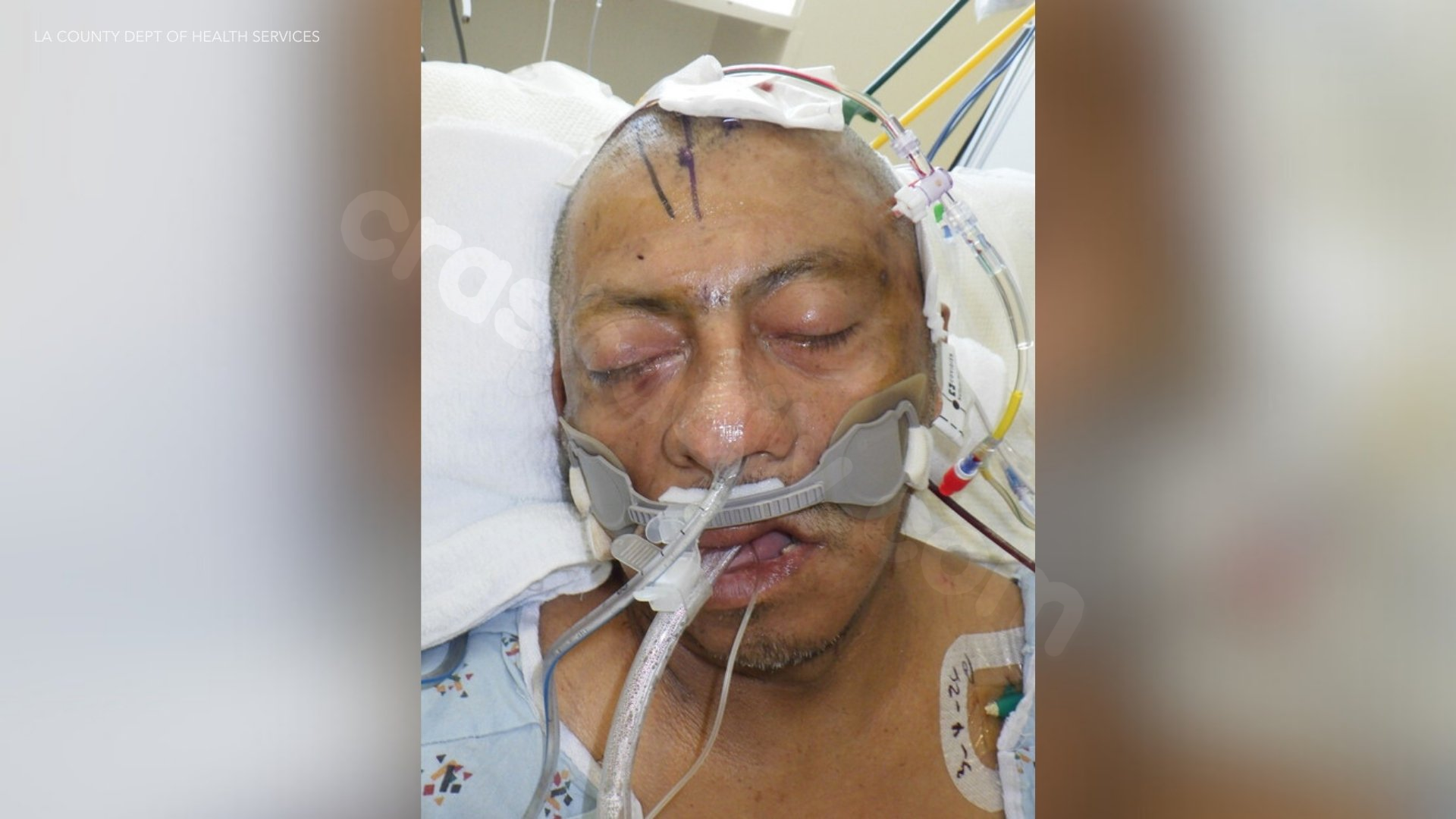 Hospital still searching for family of man hurt in 60 Freeway wreck