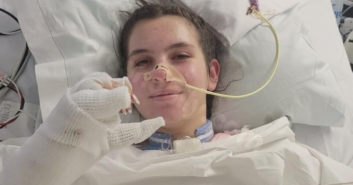 Orange County teen badly burned in Utah off-road crash returns to SoCal hospital