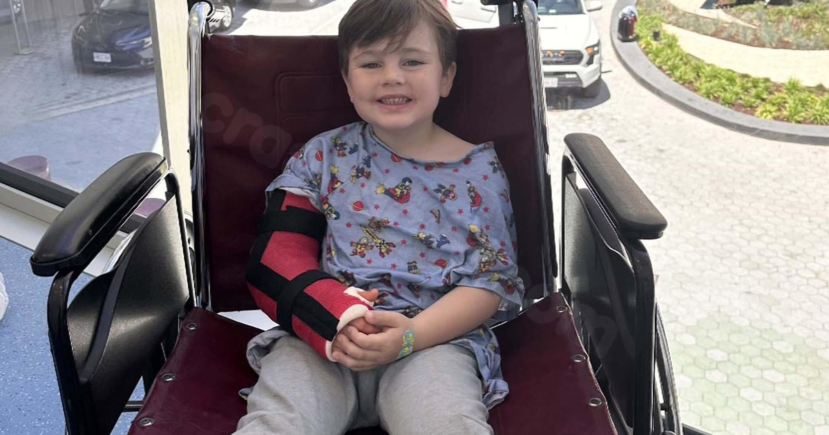 4-year-old boy's arm shattered after being struck by e-bike in Massachusetts: "Sounded like a car accident"