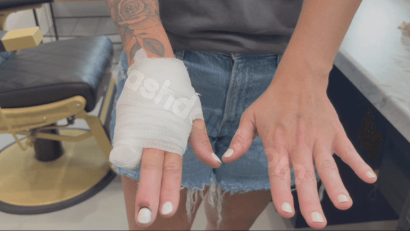 Tuttle mother shares warning after firework accident causes life-changing injury