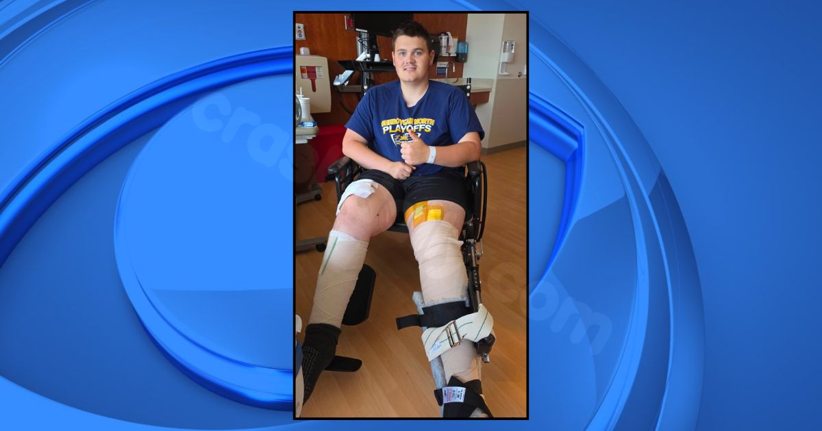 Sheboygan teen makes miraculous recovery after ‘horrible’ corn grinder accident