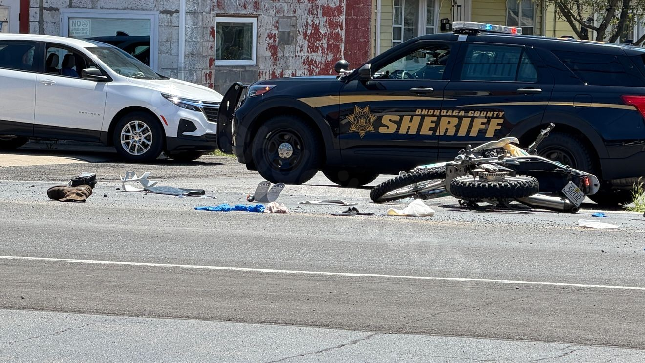 Motorcyclist hospitalized after crash in Mattydale