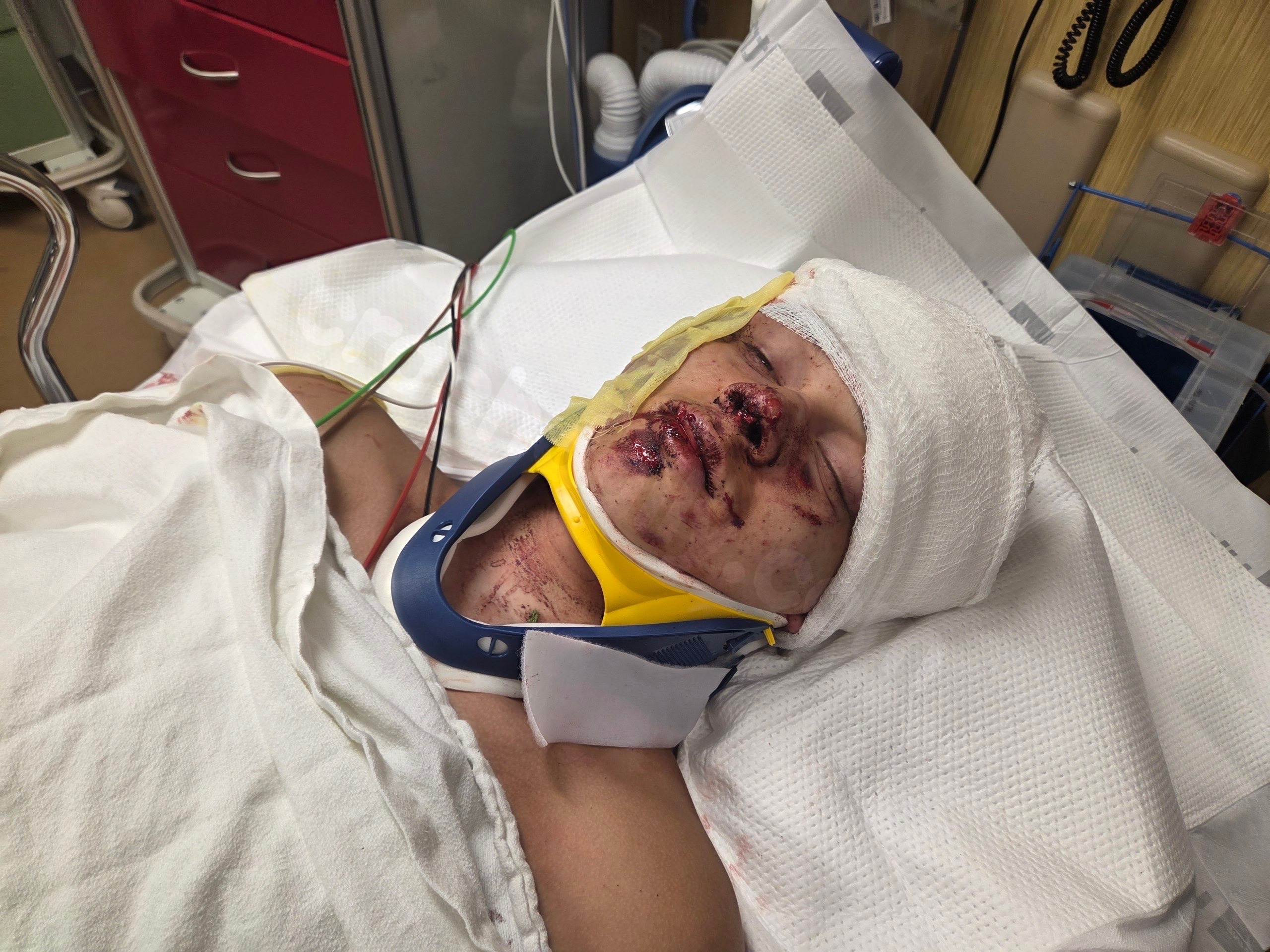 ‘His nose flipped to his eyes’: After fleeing war, Clackamas family faces new fight after teen son’s rollover crash