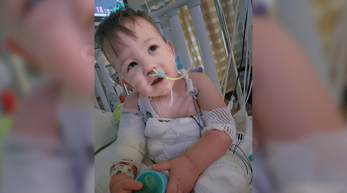 Somerset toddler faces long recovery after severe Crock-Pot burn accident